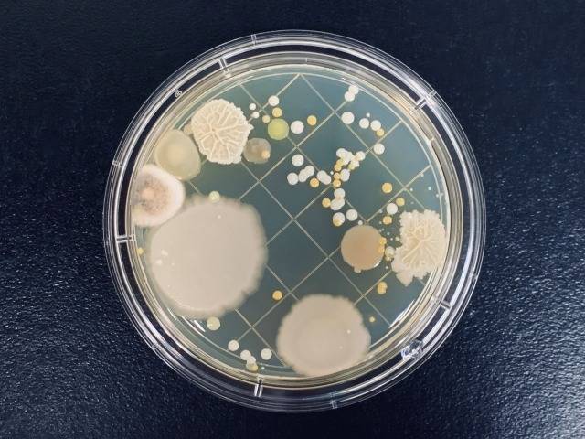 目に見えるカビは実は“コロニー”?!MIST工法®カビバスターズ本部が解説