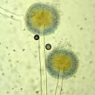 カビとは? 種類･発生原因･健康への影響をカビ取り業者が徹底解説
