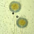 【専門家MIST工法®カビバスターズが解説】真菌とは？原因から対策まで徹底解説!