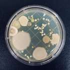 目に見えるカビは実は“コロニー”?!MIST工法®カビバスターズ本部が解説