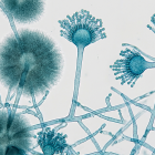 アスペルギルス・ニガーの特徴と健康被害！ プロが解説する正しいカビ除去とカビ予防方法